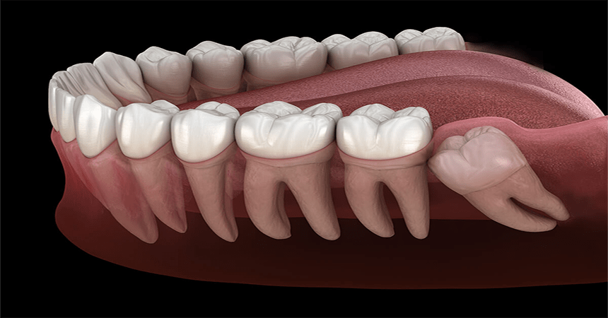 dental clinic in borsad