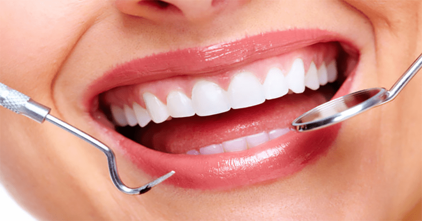 Cosmetic Dentistry in Anand