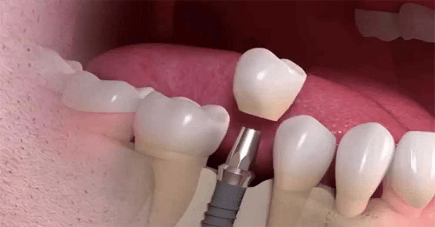 Cashless treatment Dentis in Anand