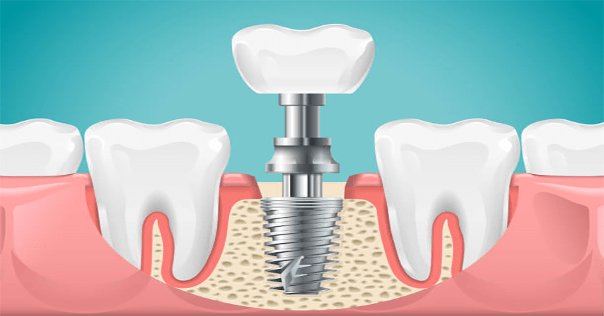 Dr Minesh Patel 32 Dental Care in anand