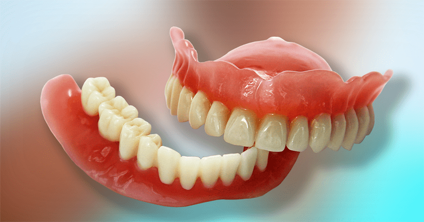 Dental Implants In Anand