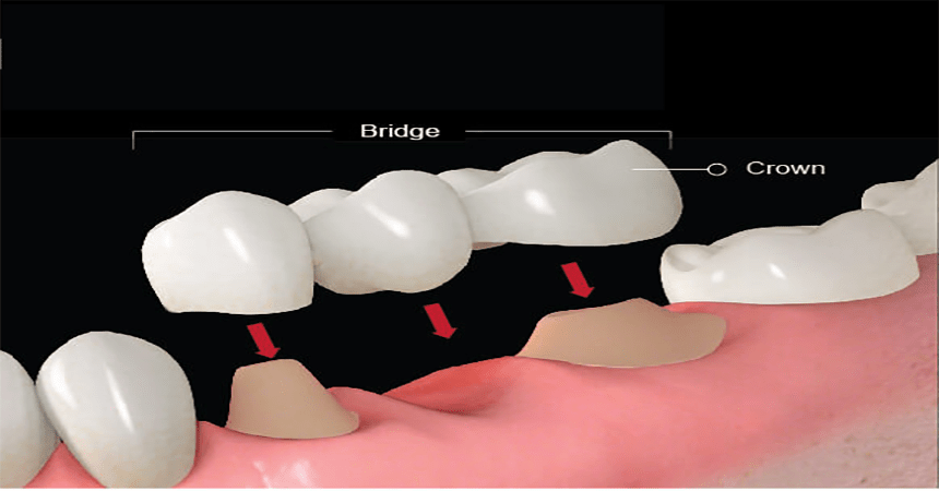 Smile design Dentist In Anand