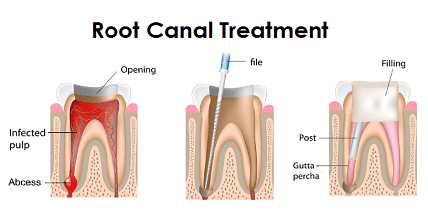 Cosmetic Dentistry in Anand